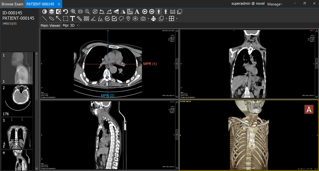 ransform your imaging experience with 3D MPR
