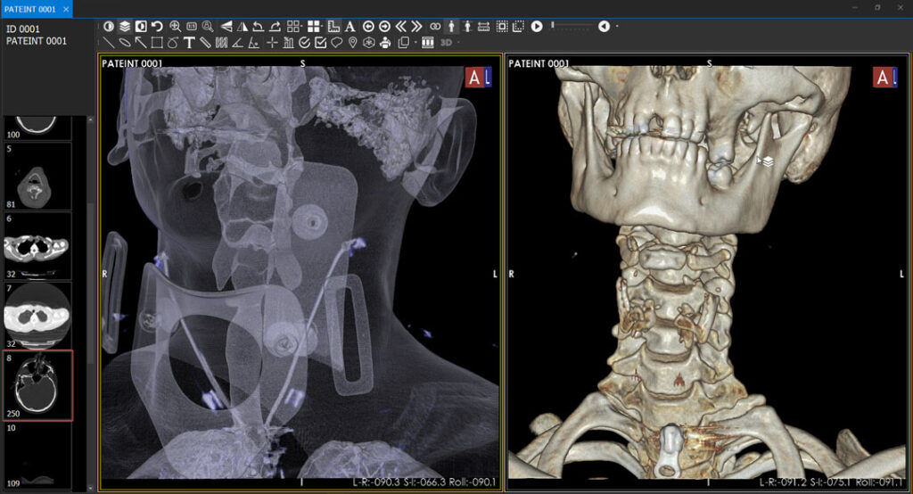 Maximize your imaging prowess with our 3D with Preset