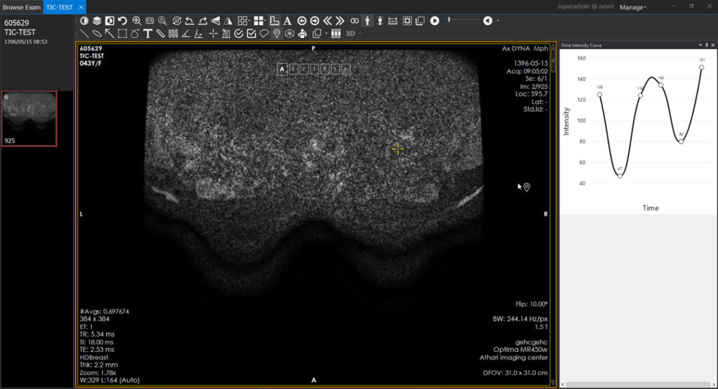 Elevate your diagnostics with TIC (Time-intensity curves)