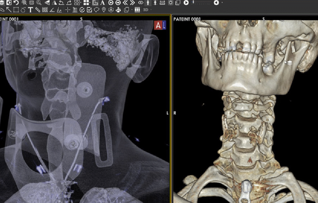 3D Volume Rendering