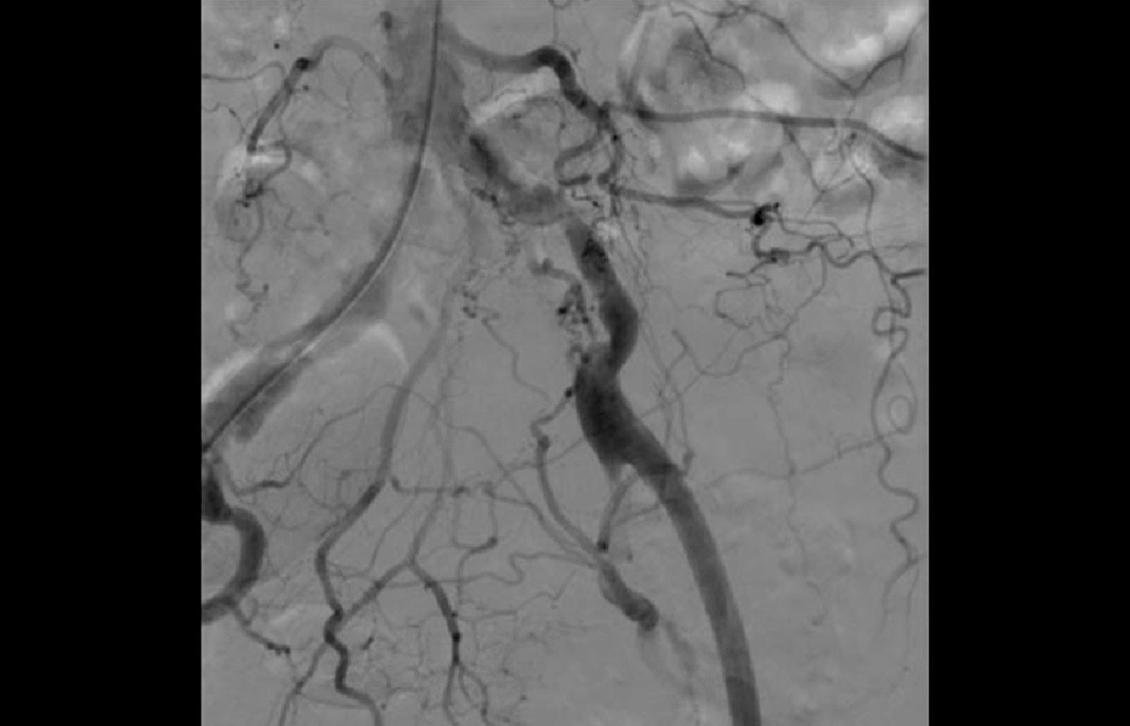 Digital Subtraction Angiography (DSA)